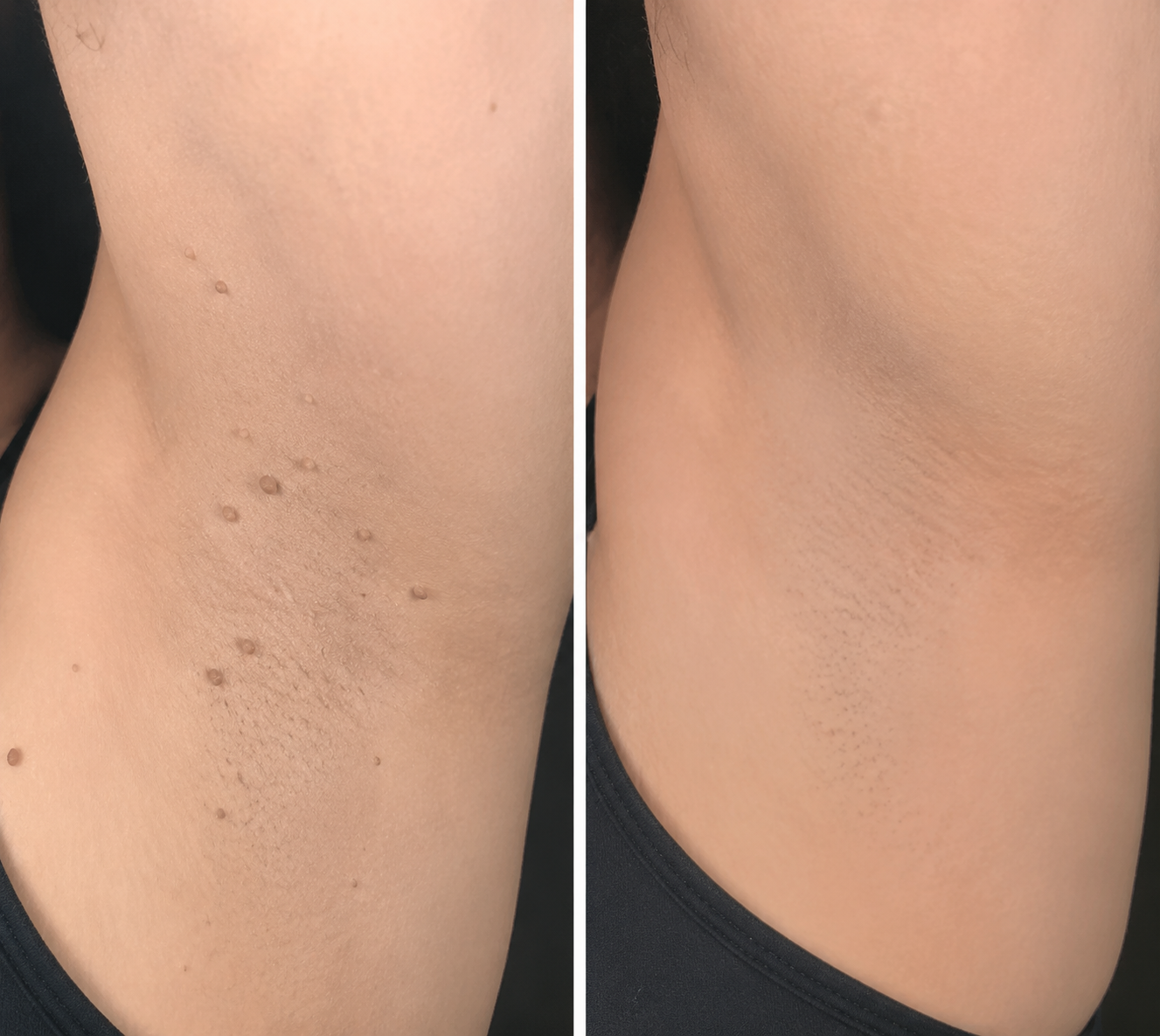 Vitacurok Skin Care Patches 🍀 | Hydrocolloid Daily Care Patches | Thin & Discreet Design | Comfortable Wear for Face & Body